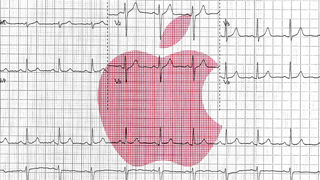 Illustration for article titled UCLA Researchers Will Use Apple Gadgets in Study to Detect and Treat Depression